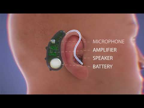 How Do Hearing Aids Work Video